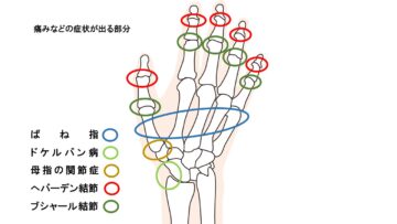 指が痛い時に疑うべき症状とは？